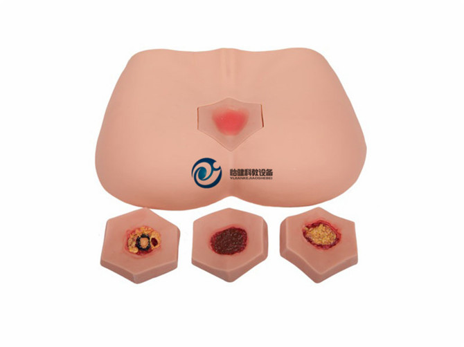 階段褥瘡護理模型