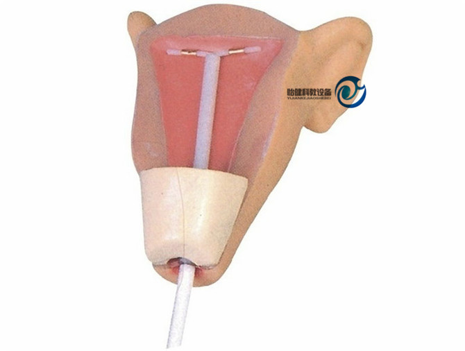 高級(jí)宮內(nèi)避孕器訓(xùn)練模型