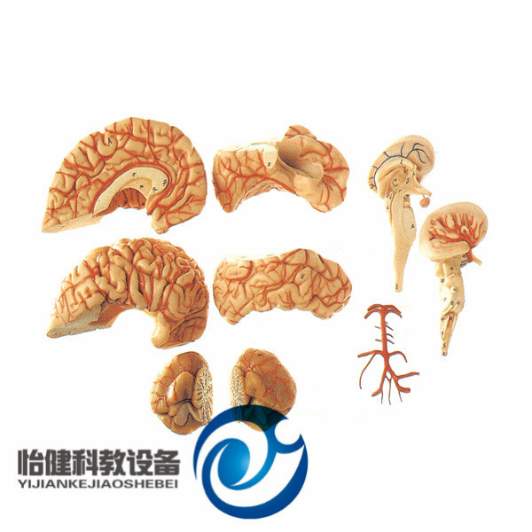 腦動脈模型