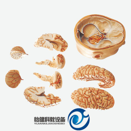 頭部附腦和動脈模型