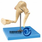 聽(tīng)小骨放大模型