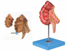 盲腸和闌尾模型