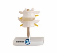 正常腰椎組合（二節(jié)）