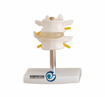 正常腰椎組合模型