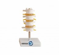 正常腰椎組合（四節）